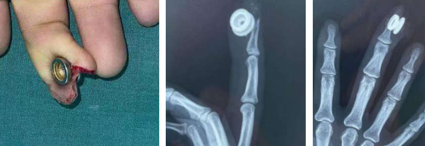 必威官方首页官网betway手外科