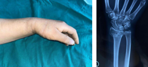 betway在线登陆手外科