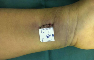 必威官方首页官网betway手外科