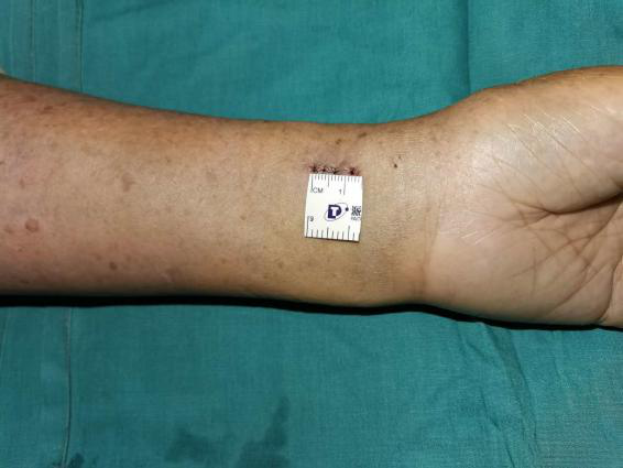 必威官方首页官网betway手外科