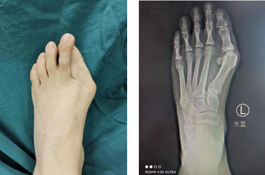 betway在线登陆足踝科