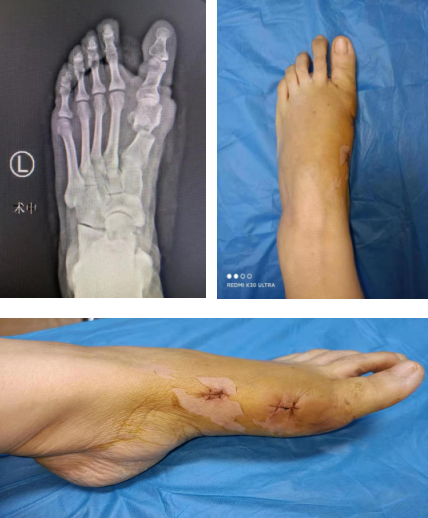 betway在线登陆足踝科