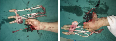 <a href='http://www.sararz.com/' target='_blank'><u>betway在线登陆</u></a>手外科