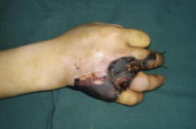 betway在线登陆手外科