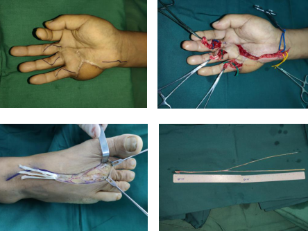 betway在线登陆手外科