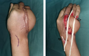 betway在线登陆手外科