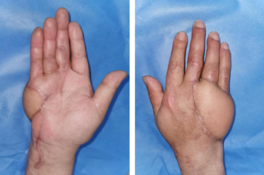 betway在线登陆手外科