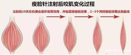 包子脸