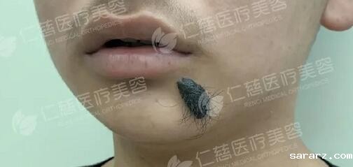 <a href='http://www.xzrcym.com/' target='_blank'><u>sararz医美</u></a>