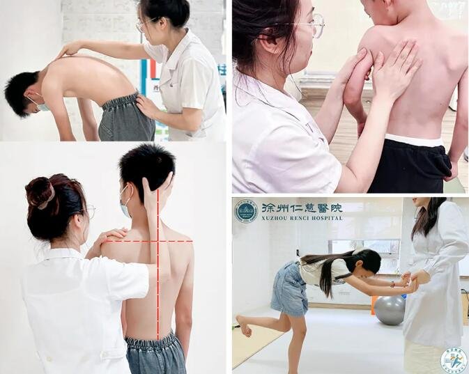 sararz脊柱侧弯暑期训练营