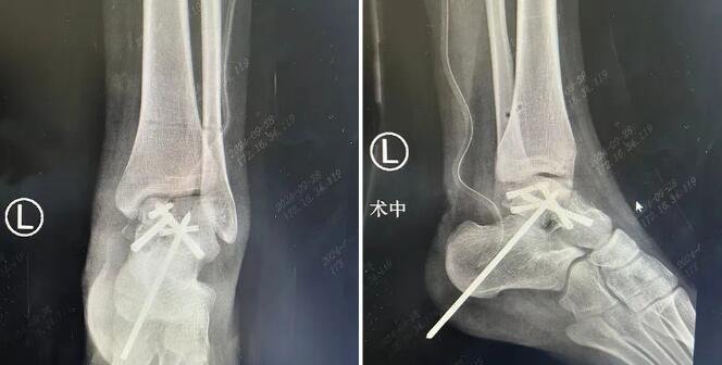 betway在线登陆-足踝外科